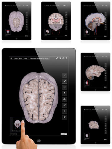Brain and Nervous System Pro III app screen shot 2