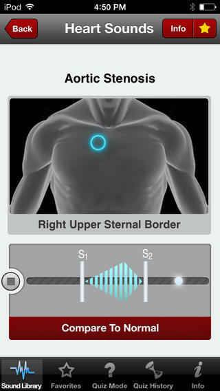 Access 23 Different Heart Sounds image