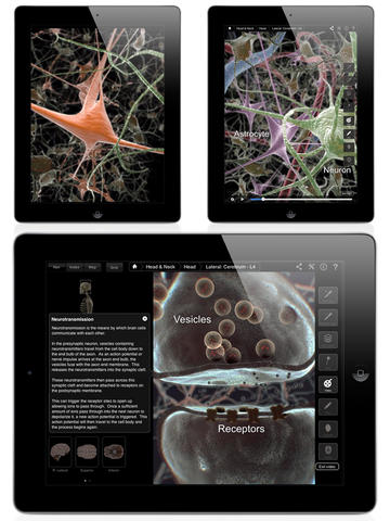 Brain and Nervous System Pro III app screen shot 3