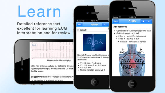 ECG Guide learn all about ECG