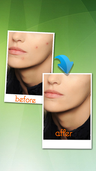 Remove blemishes